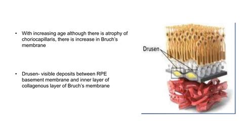 Anatomy of uvea UVEA of ophthalmology.pptx