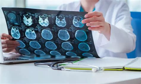 Revolutionising Ultrasound: Advancements in Hand Imaging with Lateral ...