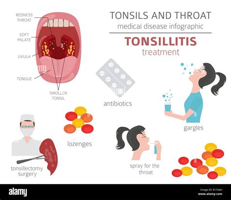 Tonsillitis Medicine