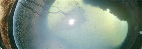 Online Panel Discussion - Interventional Therapy for Equine Corneal ...