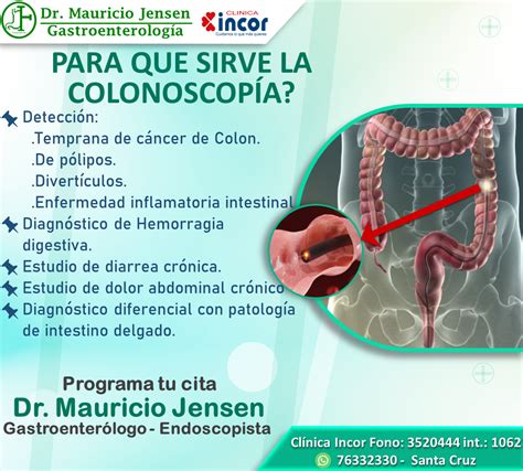 Como Es El Examen De La Colonoscopia at Steven Morton blog