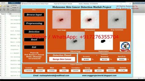 Image result for Skin Disease Detection Using MATLAB