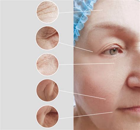 DMAE (Dimethylaminoethanol): The Youthful Contouring Agent – Caresupp.in