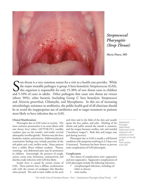 Differentials For Strep Throat at Mark Jennings blog