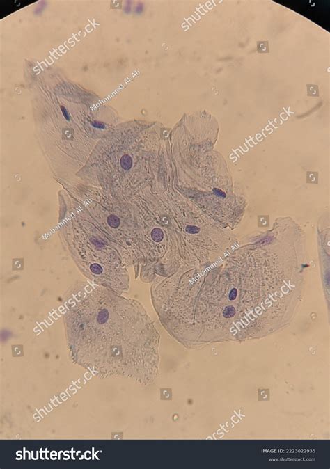 Photo Epithelial Cells Mouth Under Microscope Stock Photo 2223022935 ...