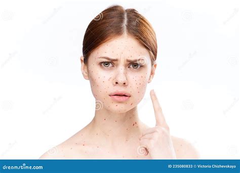 Throwing Up And Red Dots On Face at Elizabeth Wells blog