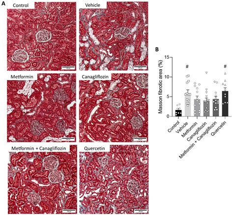 Metformin and Canagliflozin Are Equally Renoprotective in Diabetic ...
