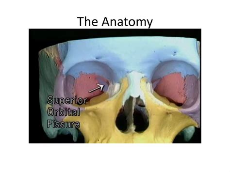 Superior Orbital Fissure Syndrome | PPTX