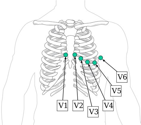 Electrocardiogram Guide (EKG/ECG) – Stepwards