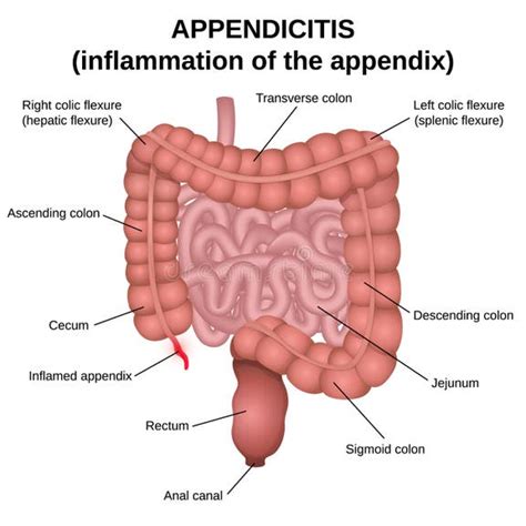 Image result for Appendix Example Website