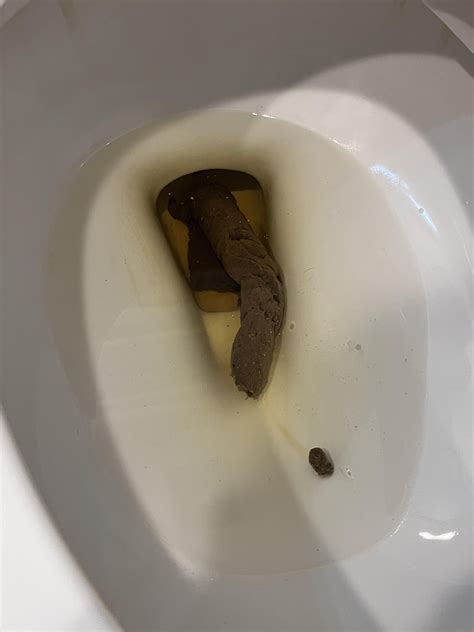 Been having a lot of gas lately and mild amount of stomach pain poops ...