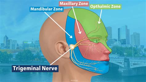 MVD Failed? Next Trigeminal Neuralgia Options — Pain Specialists Australia