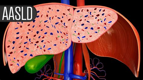 Semaglutide's MASH Benefits Extend Beyond Weight Loss | MedPage Today