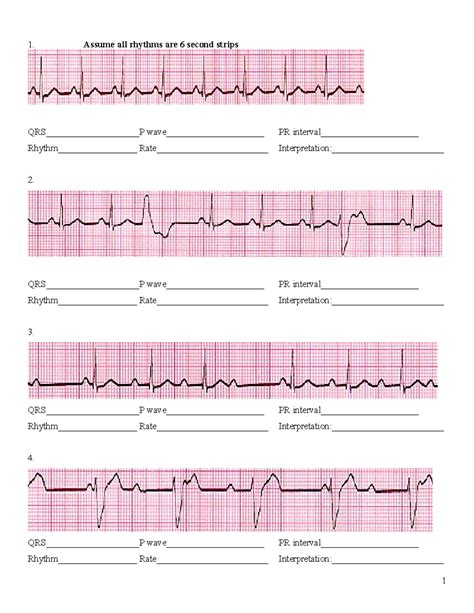 Ekg Rhythm Strips