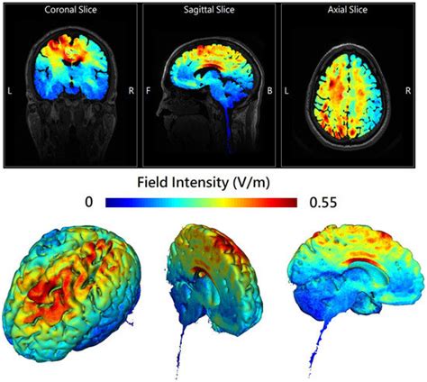 Online Left-Hemispheric In-Phase Frontoparietal Theta tACS Modulates ...