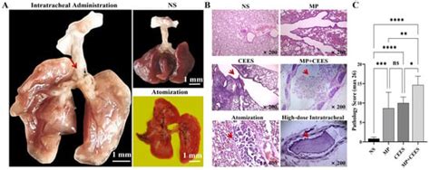 Establishment of a Mouse Model of Mycoplasma pneumoniae-Induced Plastic ...