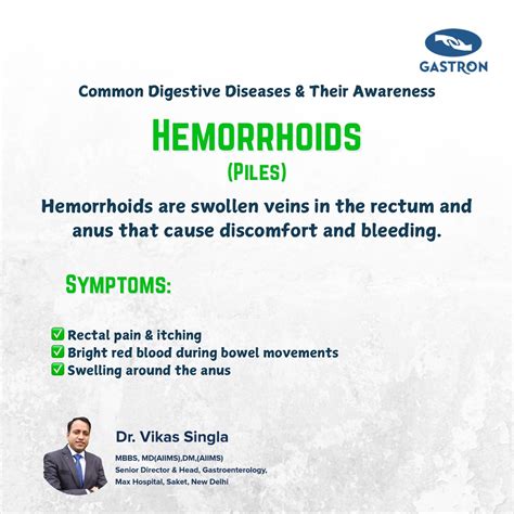 Dr. Vikas Singla | The esophagus: your body’s food highway! 🛤️ This muscular tube connects your ...