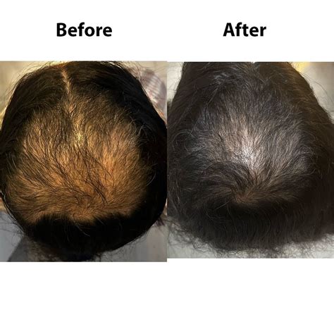 Keshpallav Plus Daily Hair Oil for Hair Growth