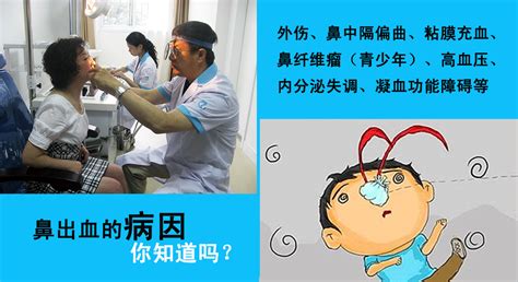 经常流鼻血是为什么_重庆耳鼻喉医院_重庆耳鼻喉医院哪家好_重庆最好的耳鼻喉医院
