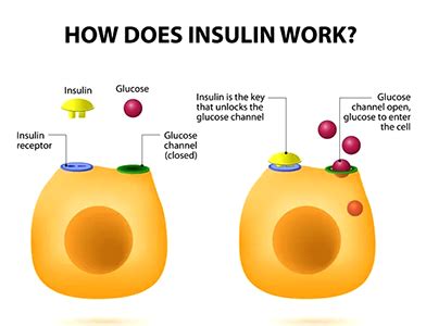 Image result for Insulin Management Algorithm