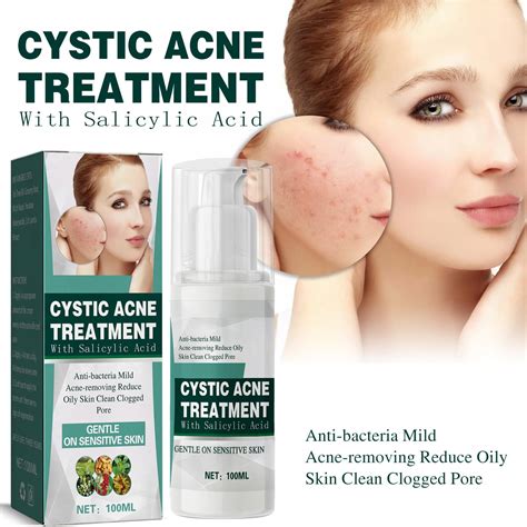 Crema para el acné quístico, hormonal y severo para adolescentes y adultos Acné con ingredientes ...