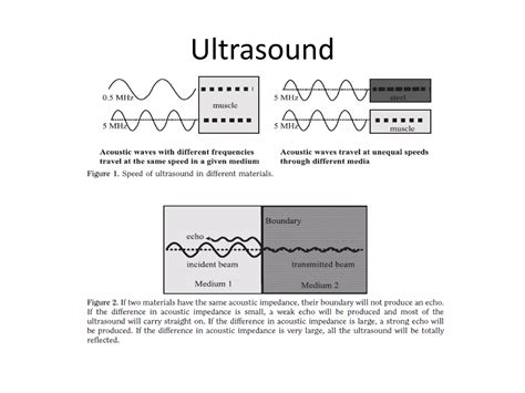 Basic physics of ultrasound imaging | PPTX