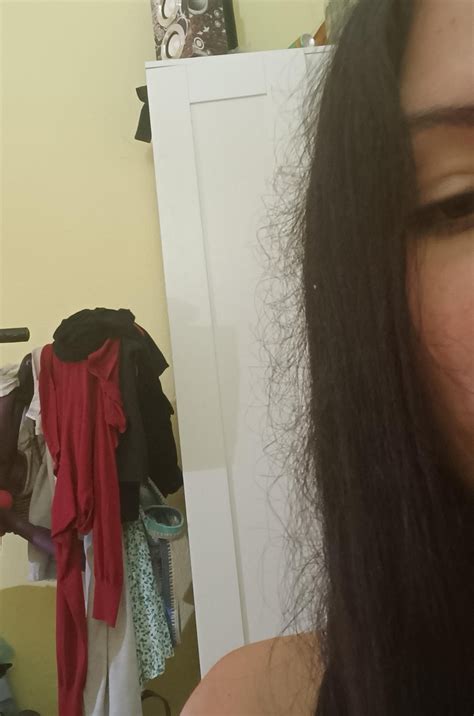 the bad part of the amazing part of hair regrowth : r/tressless