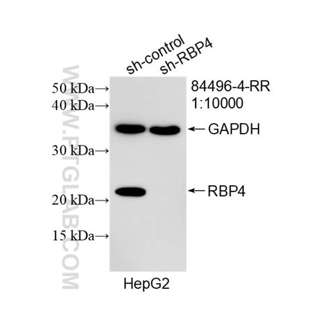 RBP4 antibody (84496-4-RR) | Proteintech