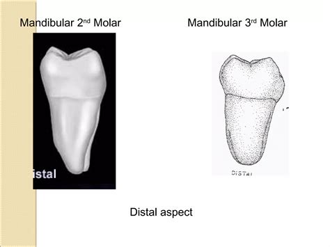 morphology of mandibular 1st,2nd,3rd molars teeth | PPT