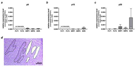 Neuroprotective Effects of VEGF in the Enteric Nervous System