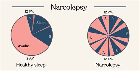 Narcolepsy Sleep Cycle Graph 的图像结果