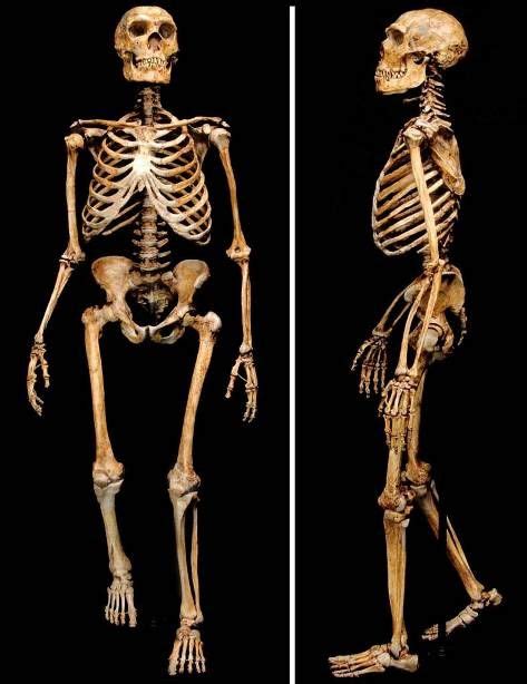 Image result for Skeleton Brain Exploding