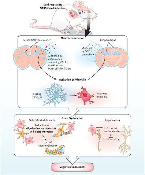Cognitive Deficits in Long Covid-19 | NEJM