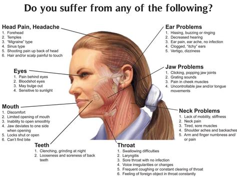 Arthritis In The Jaw | Migraine, Dental, Tubuh