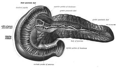 Uncinate Process Pancreas