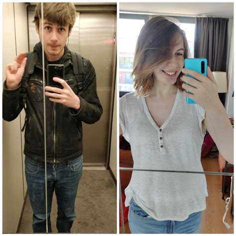 Almost a year and 9 months on HRT MtF. 2 week pre bottom surgery. I'm so lucky, I couldn't be ...