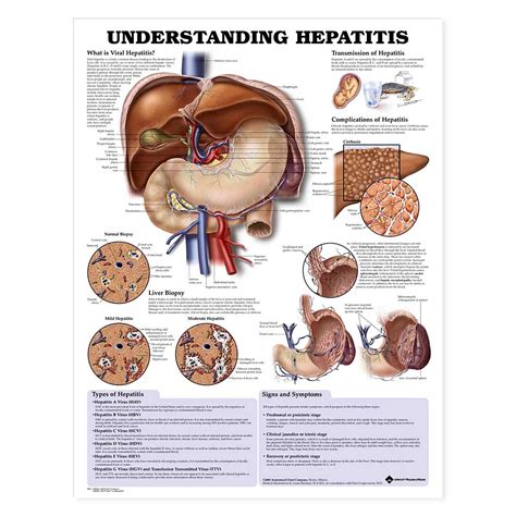 Buy Understanding Hepatitis Anatomical Chart Book Online at Low Prices ...