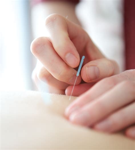 Dry Needling/IMS - Cochrane Chiropractor - Bow River Chiropractic ...