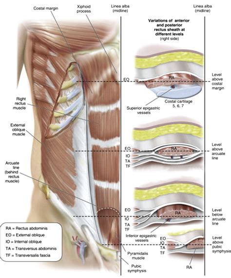 Open Ventral Hernia Repair with Component Separation - Surgical Clinics