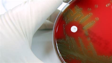 STREP 的图像结果