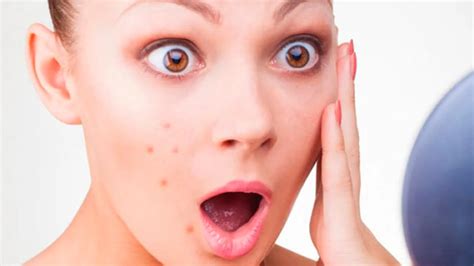 ¿Puede el maquillaje hacer que te salgan granos?