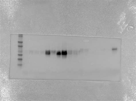 BNIP3 antibody (68091-1-Ig) | Proteintech