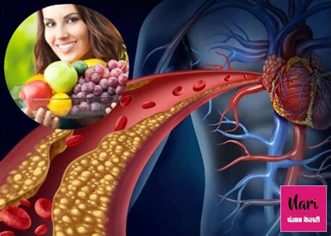 डिस्लिपिडेमिया कंट्रोल करेगी रंग-बिरंगी चीजें, जानिए अलग-अलग खाने की ...