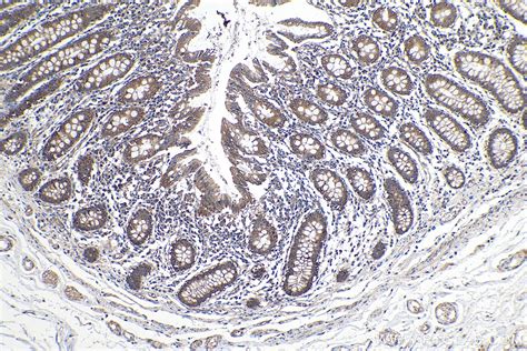 IHCeasy Cortactin Ready-To-Use IHC Kit KHC0128 | Proteintech