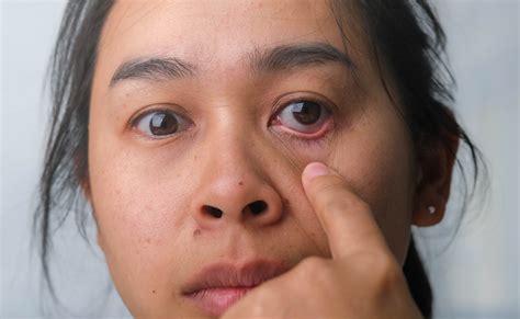 चेहरा देखकर बीमारी का लग सकता है पता, डॉक्टर ने बताया इन 5 संकेतों को ...