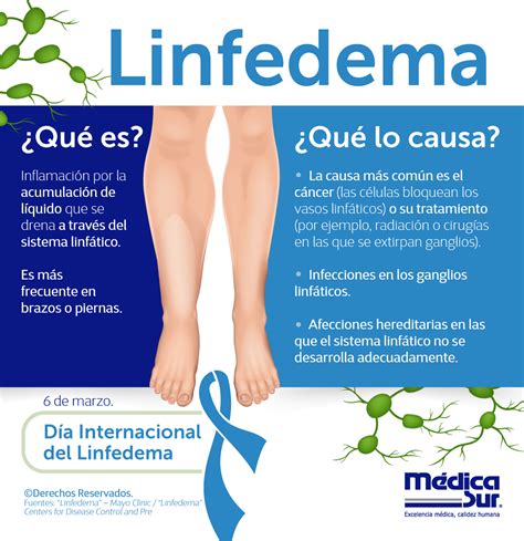 Hagamos conciencia sobre el Linfedema, un padecimiento crónico asociado ...