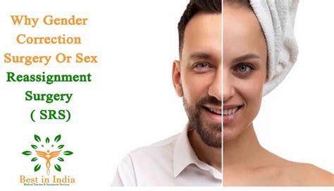 Gender Reassignment Surgery Root Operation at Clifford Zak blog