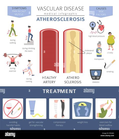 Vascular diseases. Atherosclerosis symptoms, treatment icon set. Medical infographic design ... - treat venous disease