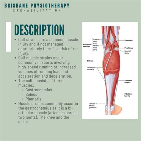 Calf Strain - Pulled or Torn Calf Muscle Injury - Brisbane ...