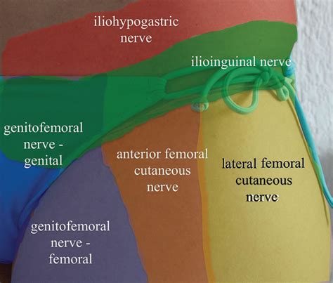 New Approach Of Ultrasoundguided Genitofemoral Nerve [PDF] Ultrasound ...